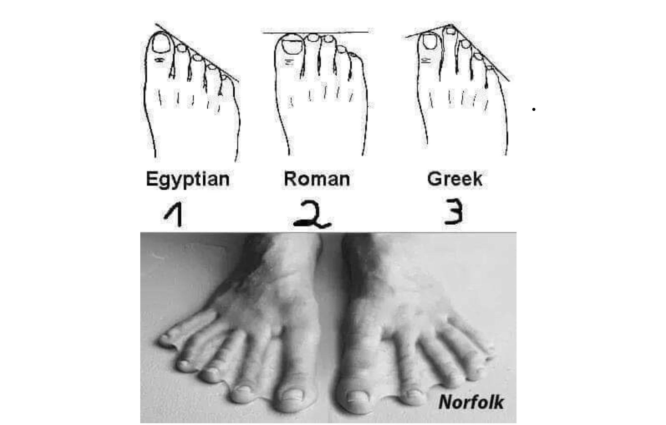 International Podiatrists honoured Norfolk feet | Suffolk Gazette